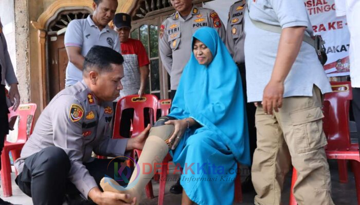 HUT Bhayangkara Ke 79, Polres Tebing Tinggi Berikan Kaki Palsu dan SIM Gratis Bagi Penyandang Disabilitas