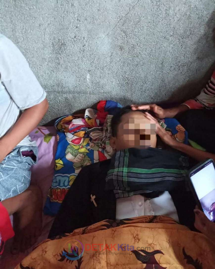 Diduga Lalai Tangani Pasien Kritis, Prof Sutan Nasomal Desak Gubernur Maluku–Bupati MBD Pecat Kapuskesmas Bebar Kumur