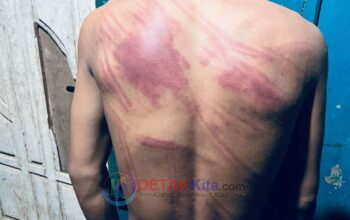 Dugaan Penganiayaan MF di PT MPP Meledak! Prof Sutan Desak Kapolda Sultra Perintahkan Kapolres Kolaka Buka Terang