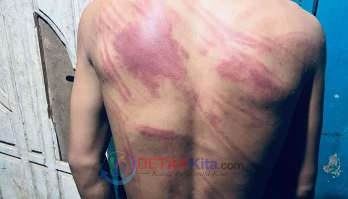 Dugaan Penganiayaan MF di PT MPP Meledak! Prof Sutan Desak Kapolda Sultra Perintahkan Kapolres Kolaka Buka Terang